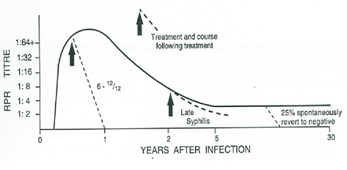 This is a graph with a Y axis representing RPR Titre levels and the X axis representing years after infection. <p>RPR usually becomes positive within 3 months of infection. In the absence of treatment, RPR titre peaks in the first year after infection then declines slowly over the course of the next 1-4 years, and remains positive at a low titre indefinitely. Treatment in the first year of infection is usually followed by a rapid decline in RPR to negative or very low titres within several months. Treatment of syphilis more than 2 years after infection usually results in a much slower decline in RPR and the RPR usually remains positive at a low titre indefinitely.