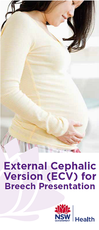 External Cephalic Version (ECV) for Breech Presentation