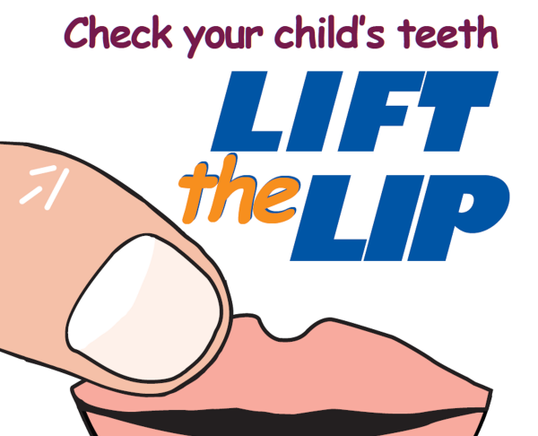 Graphic depicting finger lifting a lip. Message: Check your child's teeth. Lift the lip.